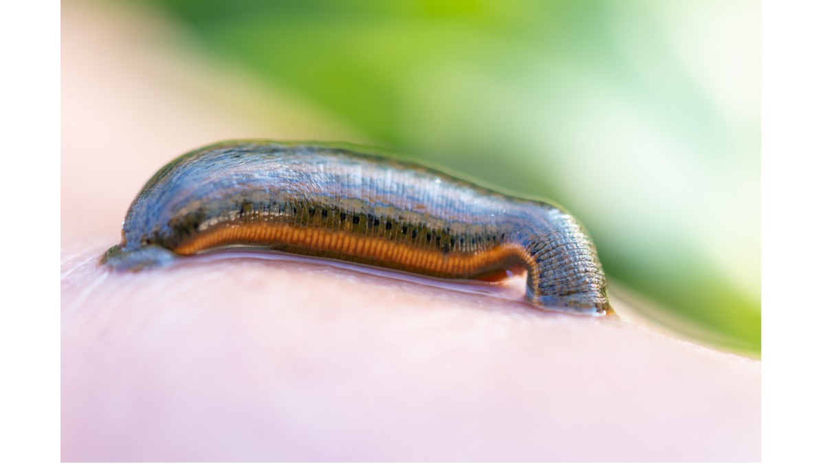 Close-up of a small leech resting on a person's skin. The leech is dark brown with a shimmering, somewhat bluish sheen. It is clearly visible and attached to the skin.